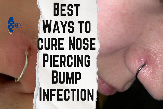 Nose Piercing Bump Infection