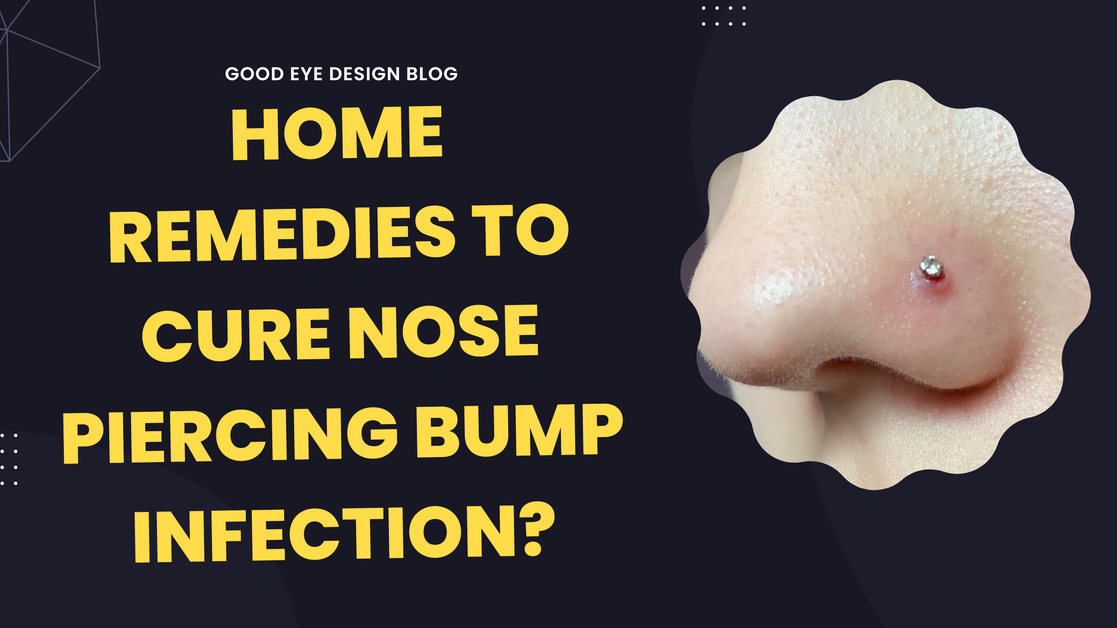 Nose Piercing Bump Infection